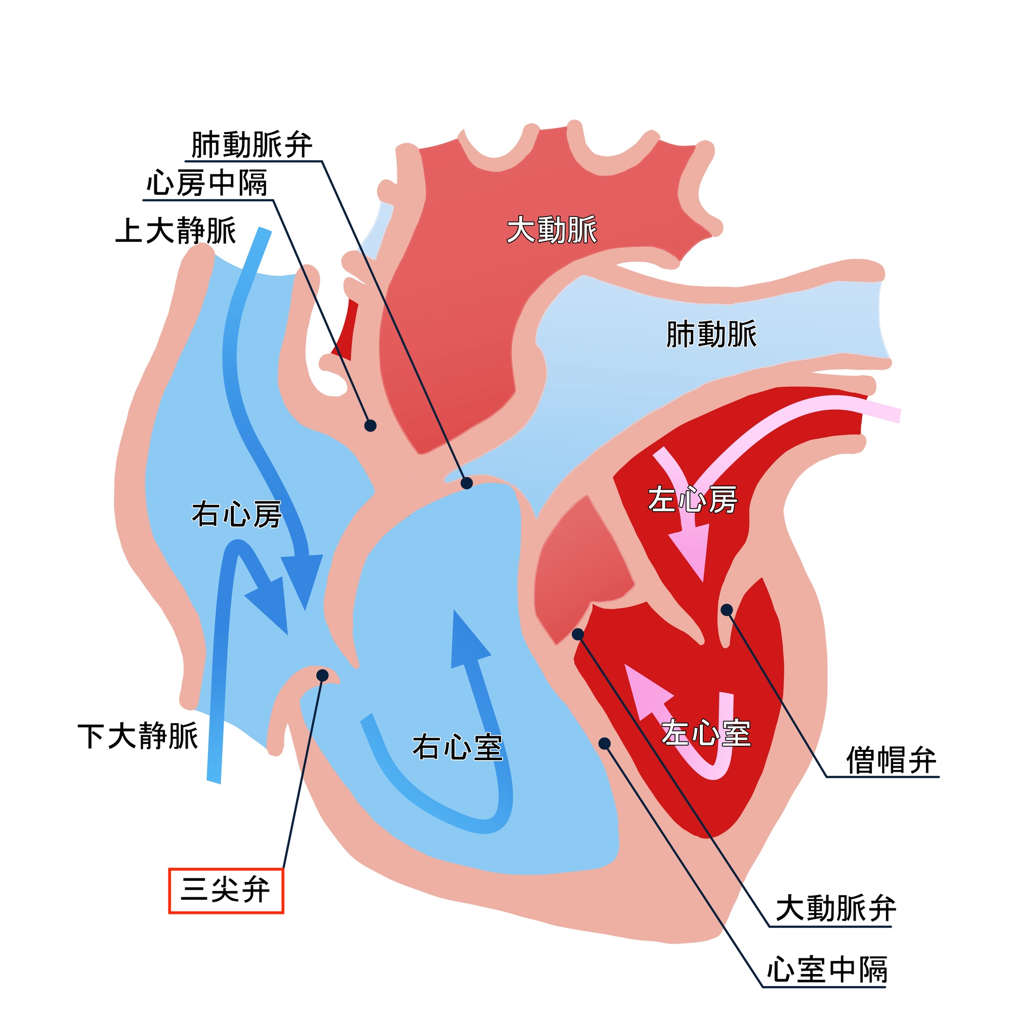 心臓 三尖弁閉鎖症について | メディカルノート