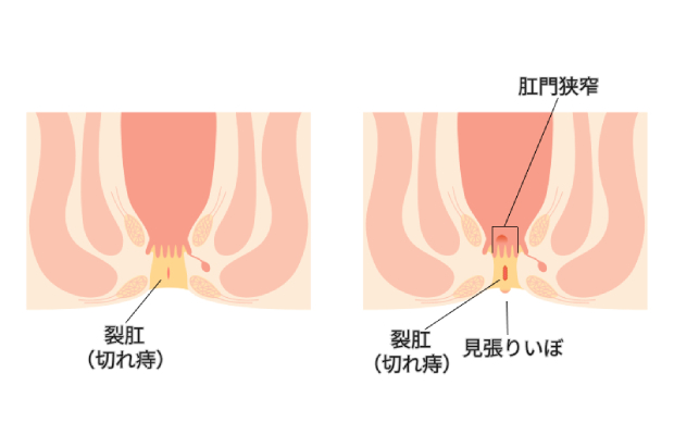 PIXTA