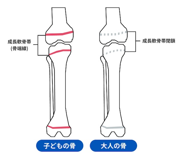 骨端線とは（画像提供：PIXTA）