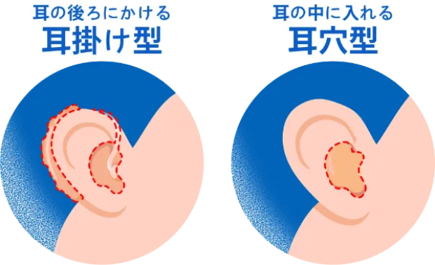 日本耳鼻咽喉科頭頸部外科学会のウェブサイトより転載