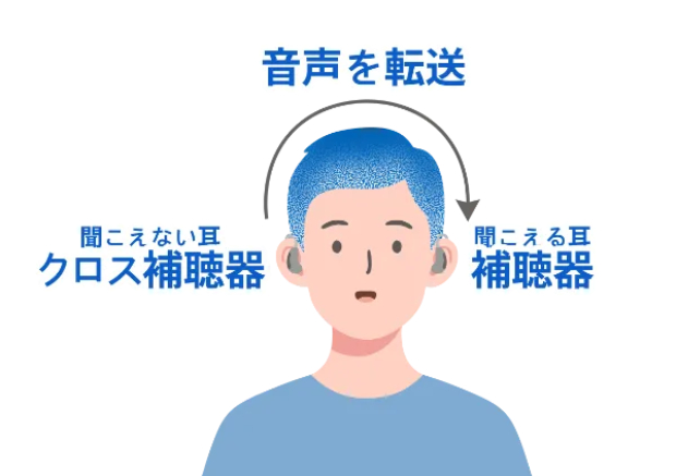 日本耳鼻咽喉科頭頸部外科学会のウェブサイトより転載[