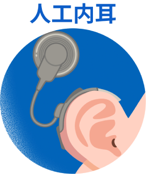 日本耳鼻咽喉科頭頸部外科学会のウェブサイトより転載[