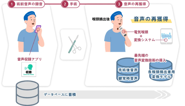 近年の「自己音声保存の取り組み」とは？