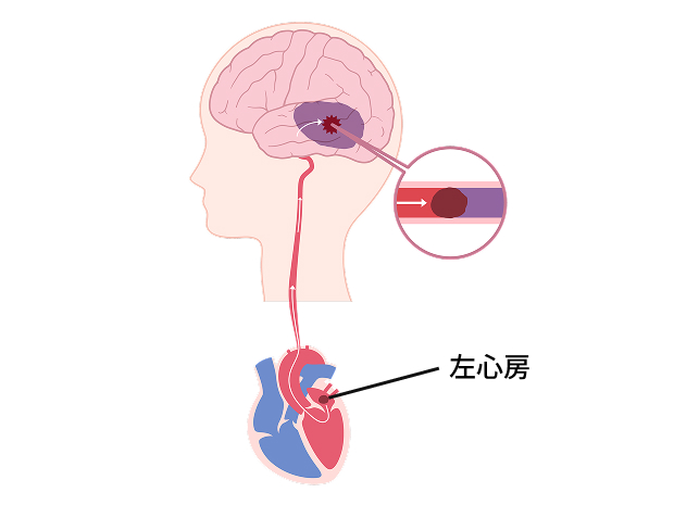 左心房